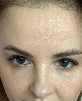Candy Alexa