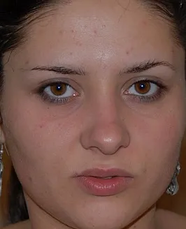 Ionella