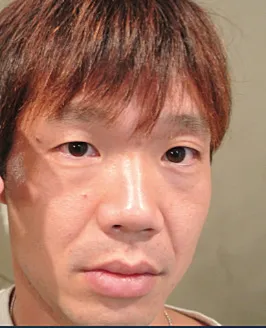 Sakurabum