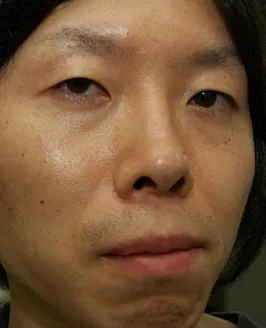 Takei