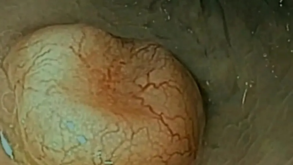 HD ASMR: Intense Anal Exploration with MILF (18+)