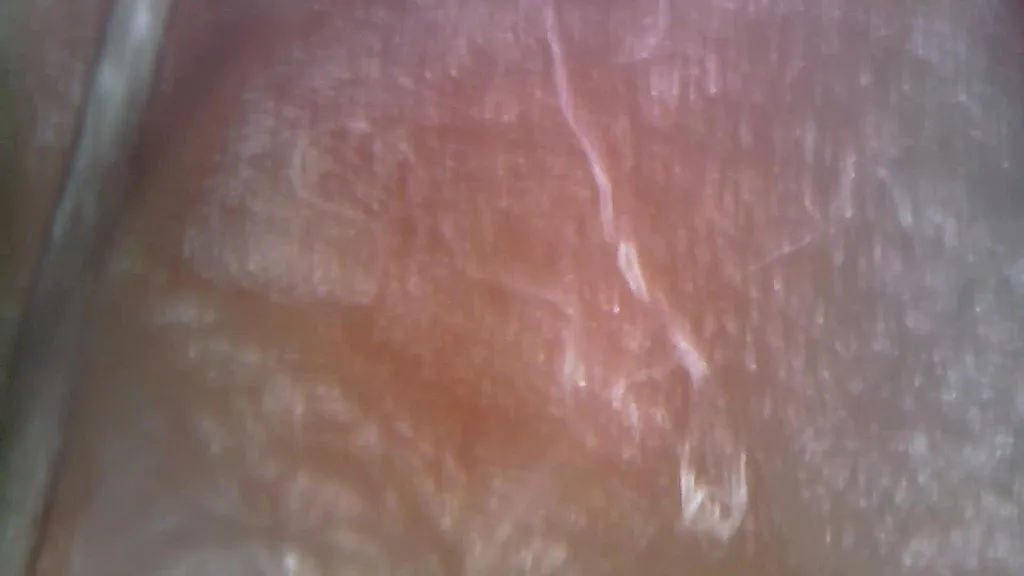 Journey Inside: Anal Exploration with Endoscope or Microscope